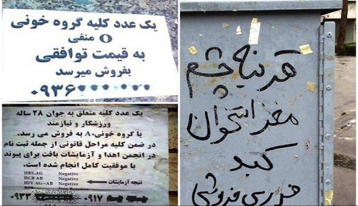 عراقیها خریدار «کلیه» ایرانیان به قیمت دلار!