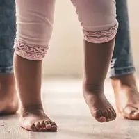 درمان پای پرانتزی در کودکان