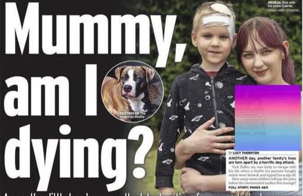 4گوشه دنیا/ حمله مرگبار سگ خانگی به پسربچه ۶ ساله در انگلیس!