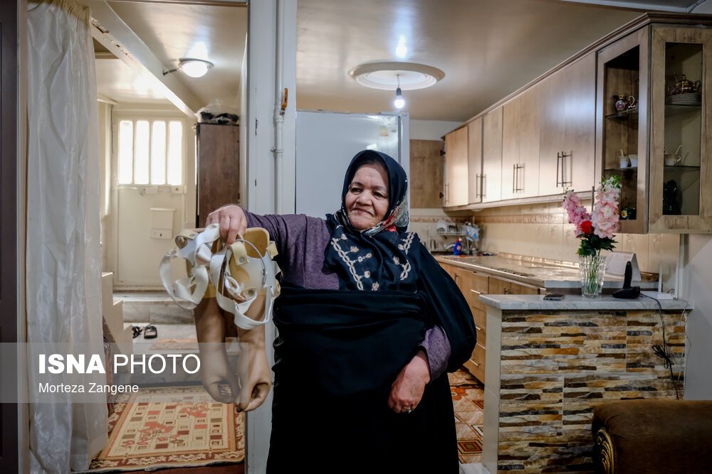 زندگی پس از قطع عضو
