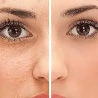 بهترین‌ خوراکی‌ برای انواع پوست را بشناسید