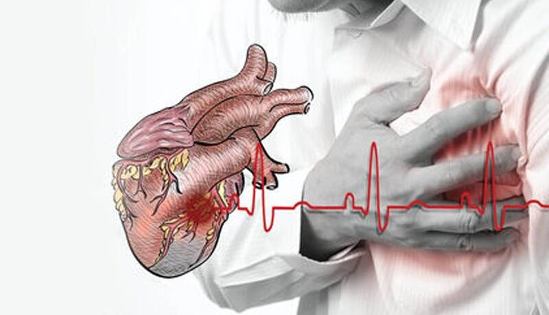علائم سکته قلبی یک ماه قبل از وقوع چیست؟