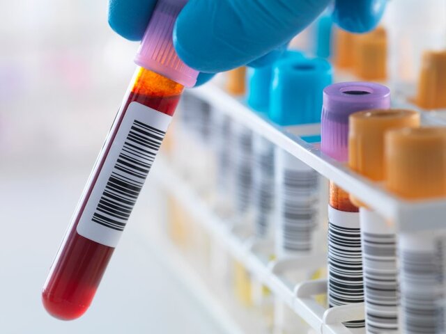 یک آزمایش خون با قابلیت تشخیص ده‌ها نوع سرطان