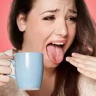 سوختگی زبان را چطور درمان کنیم؟  