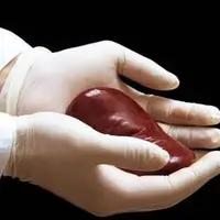 ادعایی درباره قیمت فروش کلیه