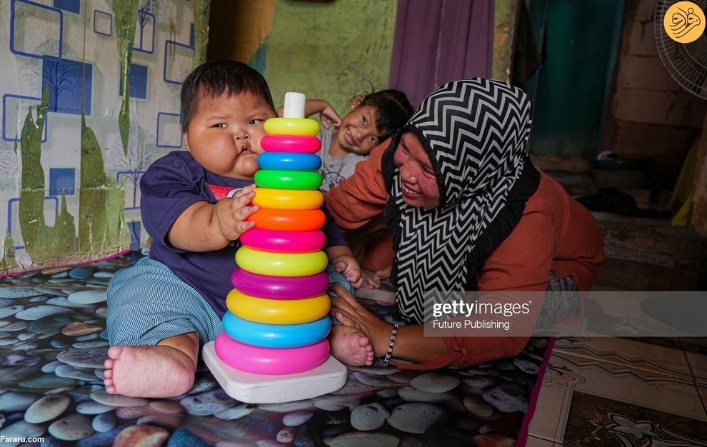 تصویری از نوزاد ۱۹ ماهه که ۲۷ کیلو وزن دارد