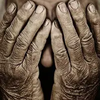 یافتن راه حلی از سوی محققان ایرانی برای مقابله با پیری پوست