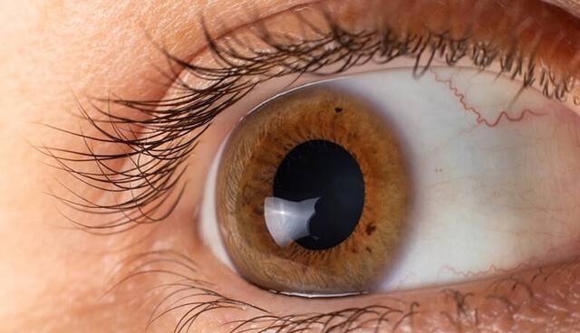 ۶ بیماری مهم که چشم‌ها در مورد آنها هشدار می‌دهند