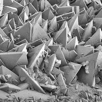 تصویر باورنکردنی سنگ کلیه زیر میکروسکوپ الکترونی