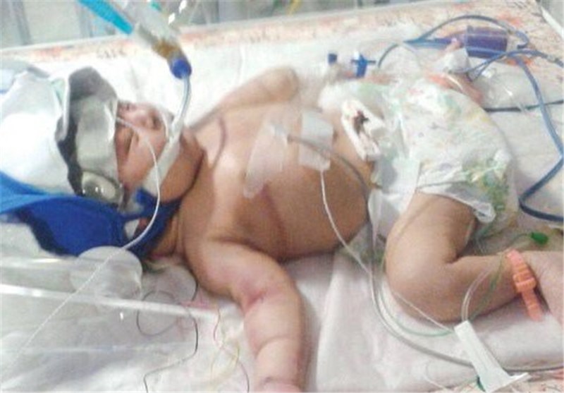 جزئیات فوت یک نوزاد در بیمارستان علیمرادیان نهاوند