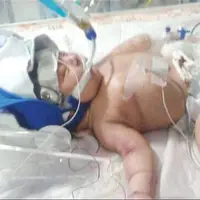 جزئیات فوت یک نوزاد در بیمارستان علیمرادیان نهاوند