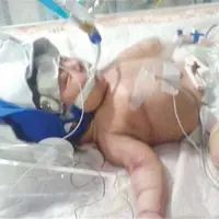 ماجرای فوت یک نوزاد در بیمارستان بخاطر نبود دارو و غیبت پزشک