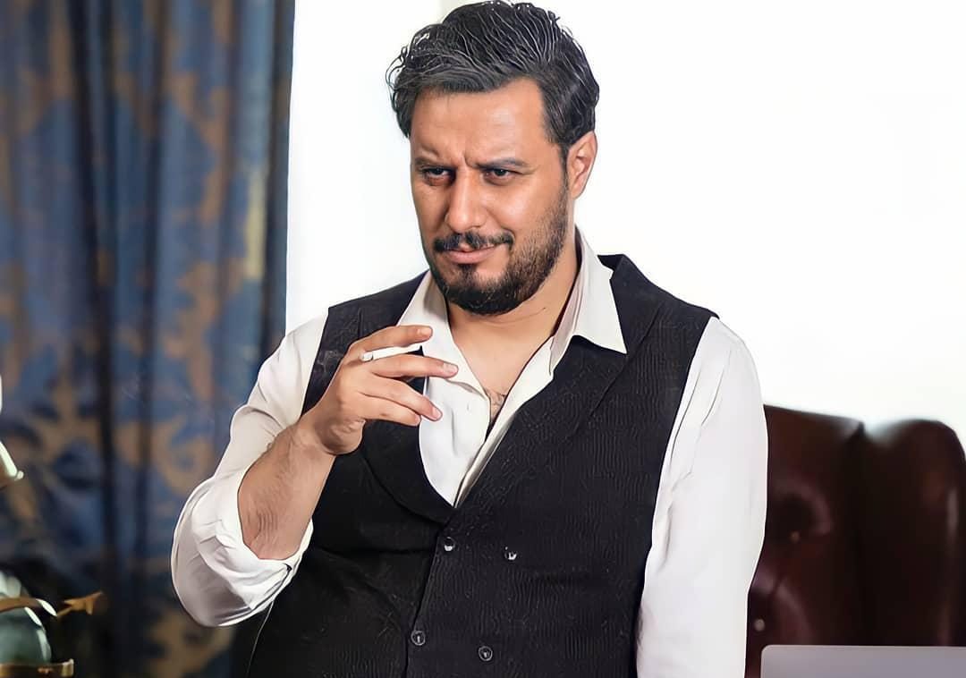 گریم متفاوت جواد عزتی برای سریال زخم‌کاری