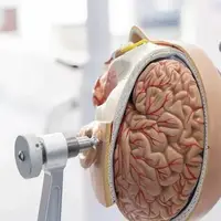 این ربات جراح تومورهای مغزی کودکان را برمی‌دارد