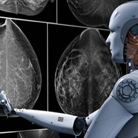 حذف دقیق‌تر تومور‌های سرطانی سینه به کمک هوش مصنوعی