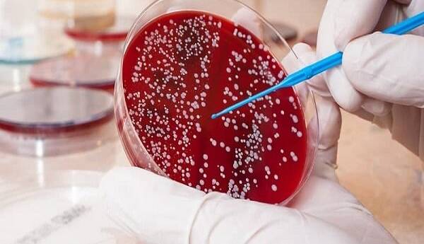 فناوران داروی درمان «سرطان خون» را ساختند