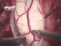 نخاع از نظر بصری