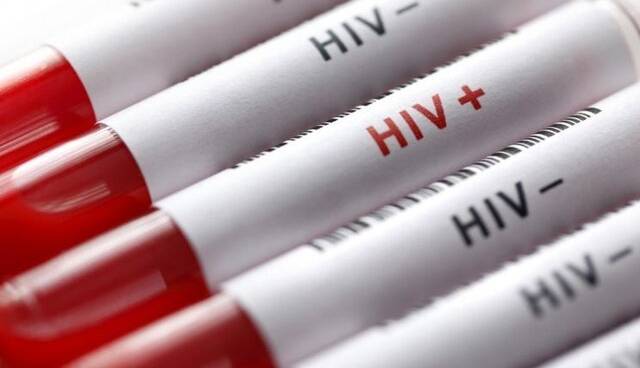 آخرین وضعیت بروز HIV در کشور