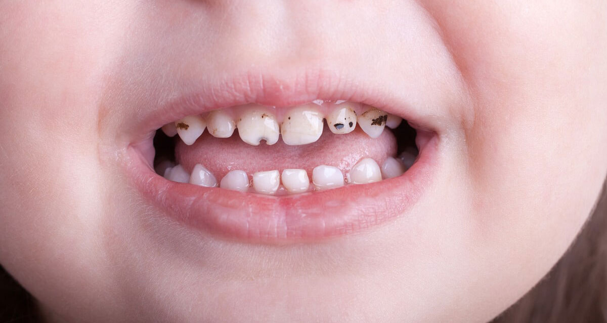 بهترین روش برای رفع ترس کودکان از دندانپزشکی