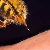 نیش زنبور قاتل سرطان است 