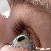 درمان سنتی مگس پران چشم و خمیازه همراه با اشک