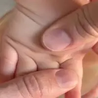 ویدئوی ترسناکی از دورهمی باکتری‌ها در کف دست یک کودک!