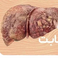 ارتباط عجیب دیابت و کبد چرب