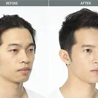  مجعزه جراحان پلاستیک کره جنوبی تا تغییر کامل چهره