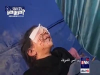 تصاویر دلخراش از زخمی شدن یک کودک در پی حملات صهیونیست‌ها