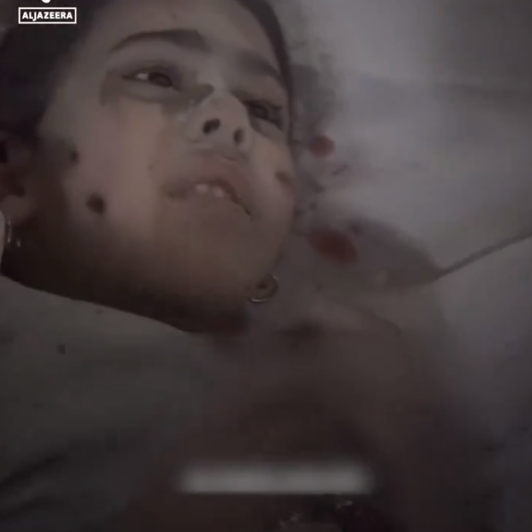 پرسش تلخ دختر زخمی فلسطینی از پزشک بیمارستان