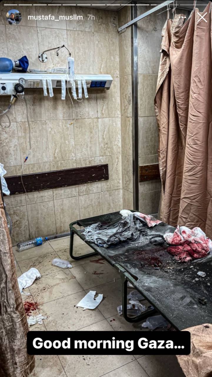 بیمارستان‌های غزه رنگ خون گرفته‌اند…