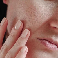 ۱۰ راز برای داشتن پوست سالم
