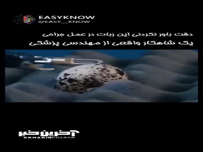 دقت باور نکردنی این ربات برای عمل جراحی