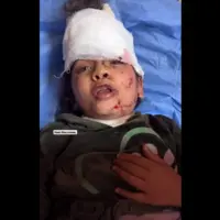 دختربچه نجات‌یافته از بمباران اسرائیل: مامان شهید شد..