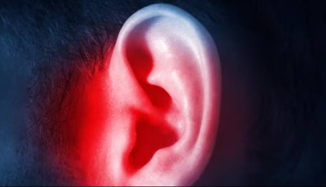محققان اپلیکیشنی برای کاهش وزوز گوش ساختند