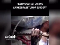 بیمار هنگام جراحی تومور مغزی گیتار نواخت!