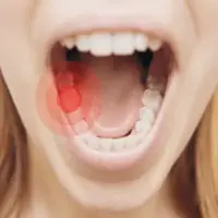 کشیدن دندان در دوران بارداری