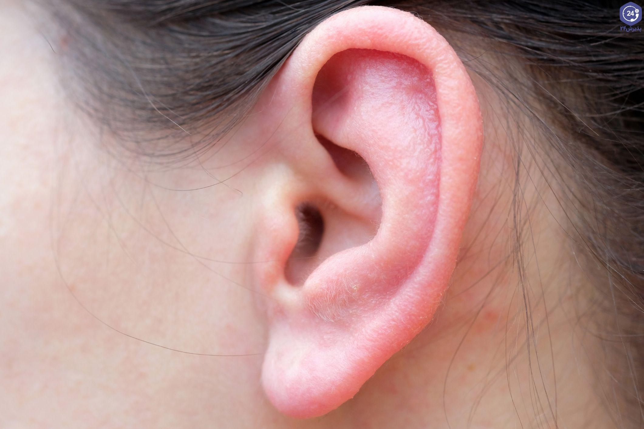 تاثیر سیر برای درمان عفونت گوش و گوش درد