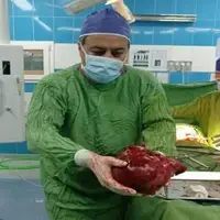 تومور ۳/۵ کیلویی از کلیه یک بیمار ۵۱ ساله در تربت حیدریه خارج شد