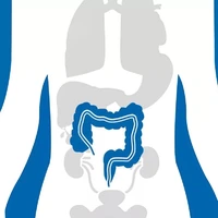 باکتری عامل پلاک دندان شاید با ابتلا به سرطان روده بزرگ ارتباط داشته باشد
