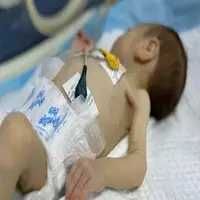 عکس/ دست و پنجه نرم کردن نوزاد شیرخواره غزه‌ای با مرگ 