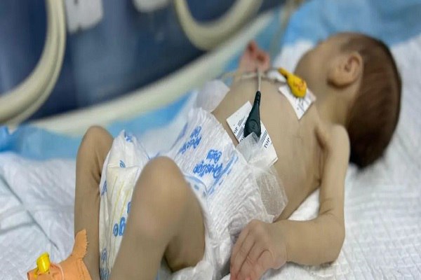عکس/ دست و پنجه نرم کردن نوزاد شیرخواره غزه‌ای با مرگ 
