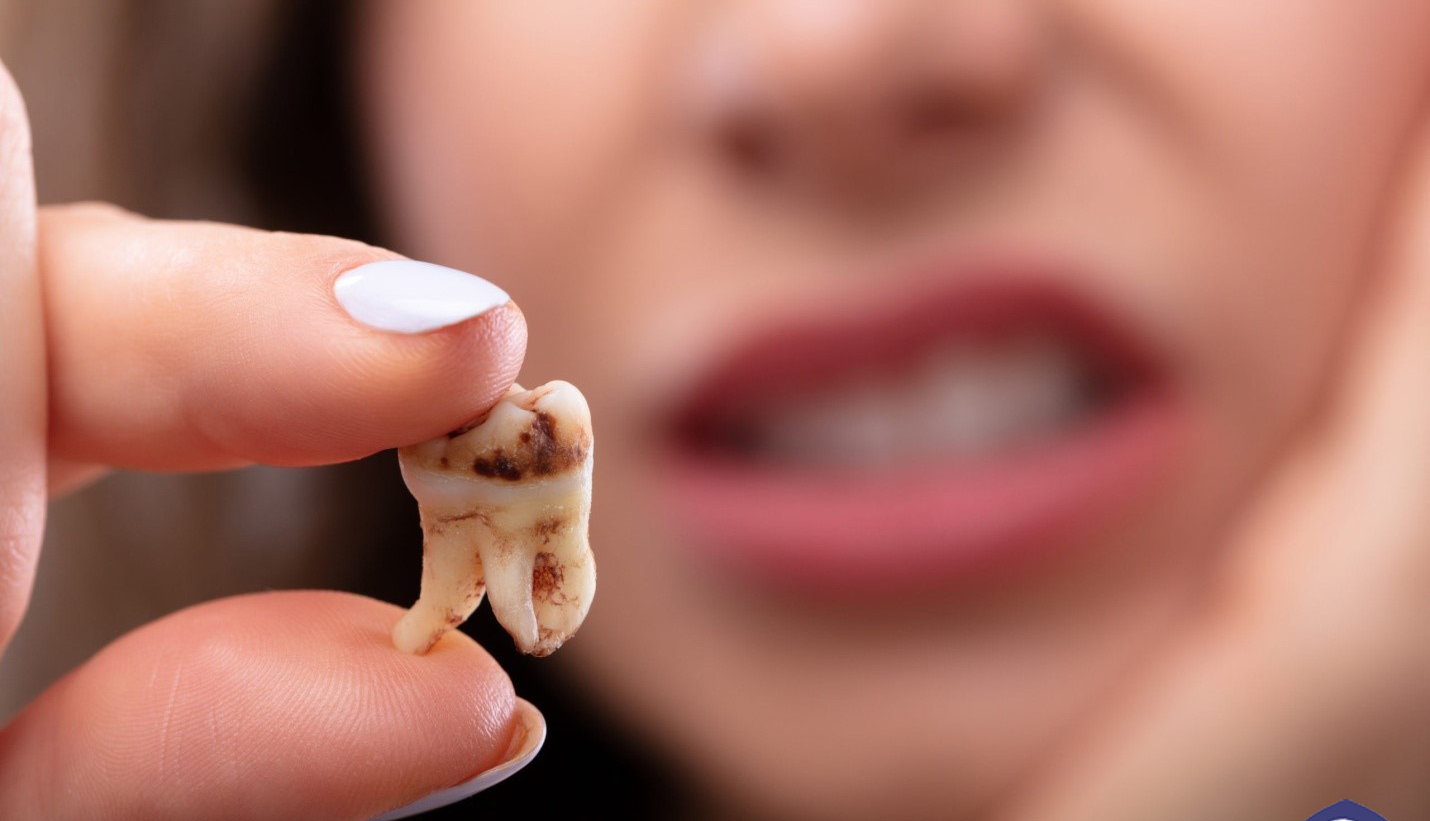 معجونی برای کاهش درد دندان ها