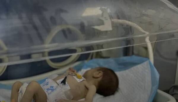 تصاویر نوزاد شیرخواره غزه‌ای که با مرگ دست و پنجه نرم می‌کند