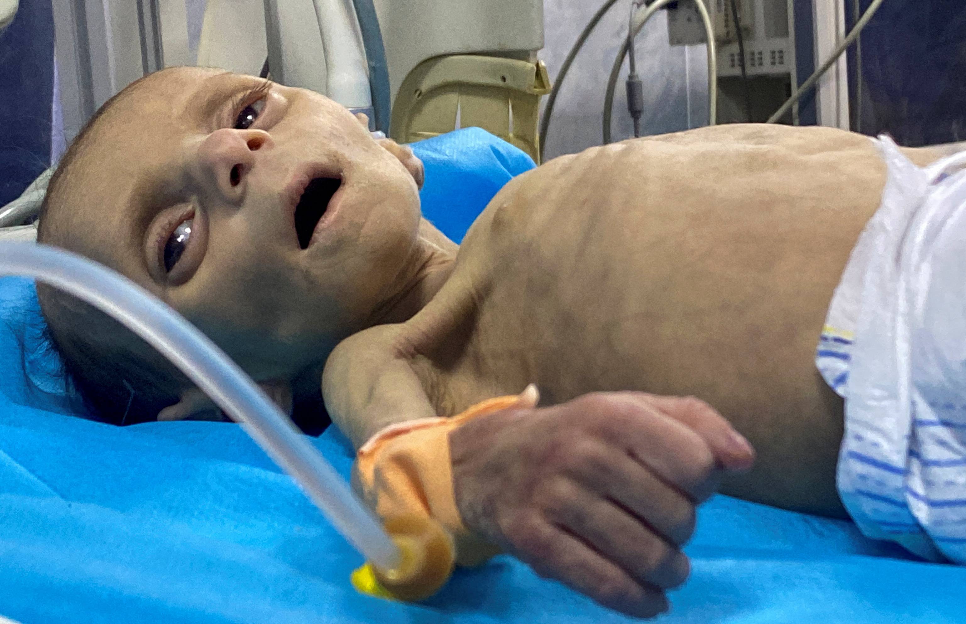 لیلی؛ نوزاد 2 ماهه‌ای که محاصره اسرائیل او را به این روز انداخته است