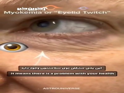 سوسو زدن چشم یا همون پریدن پلک به چه دلایلی اتفاق می‌افتد؟