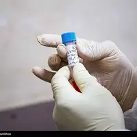 غربالگری 3 سرطان شایع طی هفته سلامت در مشهد