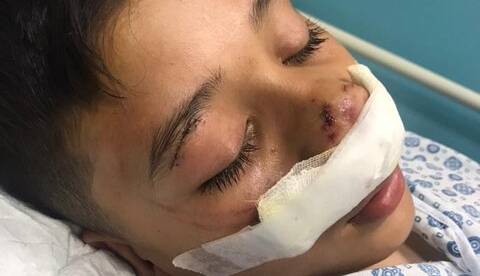 حمله سگ بلاصاحب به پسر ۱۲ساله در کرج