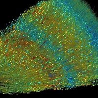 نقشه‌برداری سه‌بعدی از نمونه‌ مغز انسان به اندازه یک دانه خشخاش