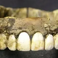 گوناگون/ منشأ چندش‌آور دندان‌های مصنوعی فاش شد!